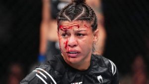 Graphic Warning! BRUTAL deep cut stops UFC 303 fight between Macy Chiasson and Mayra Bueno Silva 