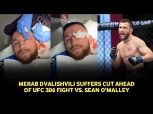 Merab Dvalishvili suffers nasty face cut just weeks before UFC 306