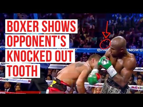 Boxer Shows Opponent's Knocked Out Tooth