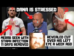 Merab Dvalishvili Has Staph Infection? Cut Over His Eye? Sean O'Malley By KO At UFC 306?